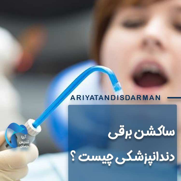 ساکشن برقی دندانپزشکی چیست؟
