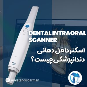 اسکنر داخل دهانی دندانپزشکی چیست؟